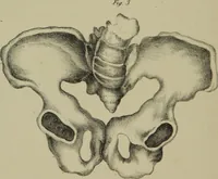 An illustration from Obstetric tables : comprising graphic illustrations, with descriptions and practical remarks : exhibiting on dissected plates many important subjects in midwifery / by G. Spratt. (1848)