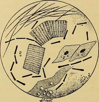 An illustration from Diagnostic methods, chemical, bacteriological and microscopical : a text-book for students and practitioners / by Ralph W. Webster ; with 37 colored plates and 164 other illustrations. (1909)
