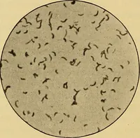 An illustration from Diagnostic methods, chemical, bacteriological and microscopical : a text-book for students and practitioners / by Ralph W. Webster ; with 37 colored plates and 164 other illustrations. (1909)