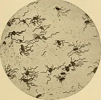 Picture 22 of 135 from Diagnostic methods, chemical, bacteriological and microscopical : a text-book for students and practitioners / by Ralph W. Webster ; with 37 colored plates and 164 other illustrations. (1909), leaf 171
