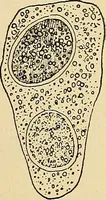 Picture 24 of 135 from Diagnostic methods, chemical, bacteriological and microscopical : a text-book for students and practitioners / by Ralph W. Webster ; with 37 colored plates and 164 other illustrations. (1909), leaf 177