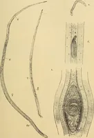 Picture 37 of 135 from Diagnostic methods, chemical, bacteriological and microscopical : a text-book for students and practitioners / by Ralph W. Webster ; with 37 colored plates and 164 other illustrations. (1909), leaf 191