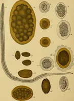 Picture 40 of 135 from Diagnostic methods, chemical, bacteriological and microscopical : a text-book for students and practitioners / by Ralph W. Webster ; with 37 colored plates and 164 other illustrations. (1909), leaf 194