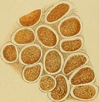 Picture 41 of 135 from Diagnostic methods, chemical, bacteriological and microscopical : a text-book for students and practitioners / by Ralph W. Webster ; with 37 colored plates and 164 other illustrations. (1909), leaf 196