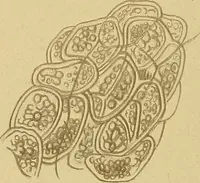 Picture 42 of 135 from Diagnostic methods, chemical, bacteriological and microscopical : a text-book for students and practitioners / by Ralph W. Webster ; with 37 colored plates and 164 other illustrations. (1909), leaf 196