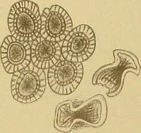 An illustration from Diagnostic methods, chemical, bacteriological and microscopical : a text-book for students and practitioners / by Ralph W. Webster ; with 37 colored plates and 164 other illustrations. (1909)