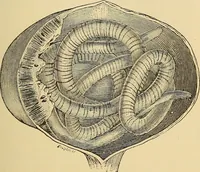 An illustration from Diagnostic methods, chemical, bacteriological and microscopical : a text-book for students and practitioners / by Ralph W. Webster ; with 37 colored plates and 164 other illustrations. (1909)