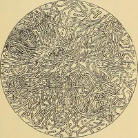 Picture 56 of 135 from Diagnostic methods, chemical, bacteriological and microscopical : a text-book for students and practitioners / by Ralph W. Webster ; with 37 colored plates and 164 other illustrations. (1909), leaf 209