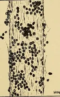 Picture 59 of 135 from Diagnostic methods, chemical, bacteriological and microscopical : a text-book for students and practitioners / by Ralph W. Webster ; with 37 colored plates and 164 other illustrations. (1909), leaf 211