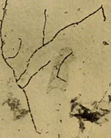An illustration from Diagnostic methods, chemical, bacteriological and microscopical : a text-book for students and practitioners / by Ralph W. Webster ; with 37 colored plates and 164 other illustrations. (1909)