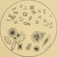 Picture 82 of 135 from Diagnostic methods, chemical, bacteriological and microscopical : a text-book for students and practitioners / by Ralph W. Webster ; with 37 colored plates and 164 other illustrations. (1909), leaf 391