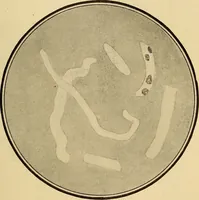 An illustration from Diagnostic methods, chemical, bacteriological and microscopical : a text-book for students and practitioners / by Ralph W. Webster ; with 37 colored plates and 164 other illustrations. (1909)