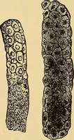 An illustration from Diagnostic methods, chemical, bacteriological and microscopical : a text-book for students and practitioners / by Ralph W. Webster ; with 37 colored plates and 164 other illustrations. (1909)