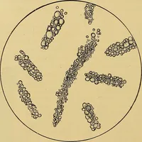 Picture 88 of 135 from Diagnostic methods, chemical, bacteriological and microscopical : a text-book for students and practitioners / by Ralph W. Webster ; with 37 colored plates and 164 other illustrations. (1909), leaf 404