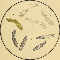 Picture 89 of 135 from Diagnostic methods, chemical, bacteriological and microscopical : a text-book for students and practitioners / by Ralph W. Webster ; with 37 colored plates and 164 other illustrations. (1909), leaf 405