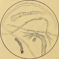 An illustration from Diagnostic methods, chemical, bacteriological and microscopical : a text-book for students and practitioners / by Ralph W. Webster ; with 37 colored plates and 164 other illustrations. (1909)