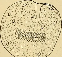 An illustration from Diagnostic methods, chemical, bacteriological and microscopical : a text-book for students and practitioners / by Ralph W. Webster ; with 37 colored plates and 164 other illustrations. (1909)