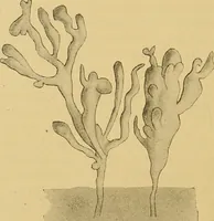 An illustration from Diagnostic methods, chemical, bacteriological and microscopical : a text-book for students and practitioners / by Ralph W. Webster ; with 37 colored plates and 164 other illustrations. (1909)