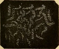 Picture 2 of 135 from Diagnostic methods, chemical, bacteriological and microscopical : a text-book for students and practitioners / by Ralph W. Webster ; with 37 colored plates and 164 other illustrations. (1909), leaf 45