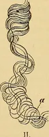 An illustration from Diagnostic methods, chemical, bacteriological and microscopical : a text-book for students and practitioners / by Ralph W. Webster ; with 37 colored plates and 164 other illustrations. (1909)