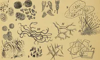 An illustration from Diagnostic methods, chemical, bacteriological and microscopical : a text-book for students and practitioners / by Ralph W. Webster ; with 37 colored plates and 164 other illustrations. (1909)