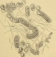 Picture 115 of 135 from Diagnostic methods, chemical, bacteriological and microscopical : a text-book for students and practitioners / by Ralph W. Webster ; with 37 colored plates and 164 other illustrations. (1909), leaf 529