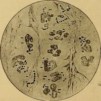 Picture 6 of 135 from Diagnostic methods, chemical, bacteriological and microscopical : a text-book for students and practitioners / by Ralph W. Webster ; with 37 colored plates and 164 other illustrations. (1909), leaf 54