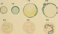 Picture 116 of 135 from Diagnostic methods, chemical, bacteriological and microscopical : a text-book for students and practitioners / by Ralph W. Webster ; with 37 colored plates and 164 other illustrations. (1909), leaf 551