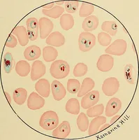 Picture 119 of 135 from Diagnostic methods, chemical, bacteriological and microscopical : a text-book for students and practitioners / by Ralph W. Webster ; with 37 colored plates and 164 other illustrations. (1909), leaf 647