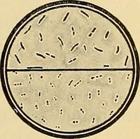 An illustration from Diagnostic methods, chemical, bacteriological and microscopical : a text-book for students and practitioners / by Ralph W. Webster ; with 37 colored plates and 164 other illustrations. (1909)
