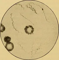 Picture 121 of 135 from Diagnostic methods, chemical, bacteriological and microscopical : a text-book for students and practitioners / by Ralph W. Webster ; with 37 colored plates and 164 other illustrations. (1909), leaf 652