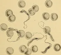 An illustration from Diagnostic methods, chemical, bacteriological and microscopical : a text-book for students and practitioners / by Ralph W. Webster ; with 37 colored plates and 164 other illustrations. (1909)