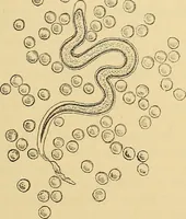 An illustration from Diagnostic methods, chemical, bacteriological and microscopical : a text-book for students and practitioners / by Ralph W. Webster ; with 37 colored plates and 164 other illustrations. (1909)