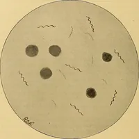 An illustration from Diagnostic methods, chemical, bacteriological and microscopical : a text-book for students and practitioners / by Ralph W. Webster ; with 37 colored plates and 164 other illustrations. (1909)