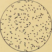 Picture 127 of 135 from Diagnostic methods, chemical, bacteriological and microscopical : a text-book for students and practitioners / by Ralph W. Webster ; with 37 colored plates and 164 other illustrations. (1909), leaf 666