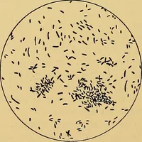 Picture 128 of 135 from Diagnostic methods, chemical, bacteriological and microscopical : a text-book for students and practitioners / by Ralph W. Webster ; with 37 colored plates and 164 other illustrations. (1909), leaf 666