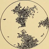 Picture 129 of 135 from Diagnostic methods, chemical, bacteriological and microscopical : a text-book for students and practitioners / by Ralph W. Webster ; with 37 colored plates and 164 other illustrations. (1909), leaf 667