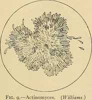 Picture 9 of 135 from Diagnostic methods, chemical, bacteriological and microscopical : a text-book for students and practitioners / by Ralph W. Webster ; with 37 colored plates and 164 other illustrations. (1909), leaf 69
