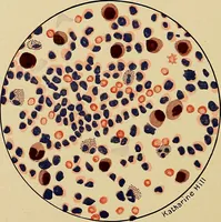 Picture 134 of 135 from Diagnostic methods, chemical, bacteriological and microscopical : a text-book for students and practitioners / by Ralph W. Webster ; with 37 colored plates and 164 other illustrations. (1909), leaf 700
