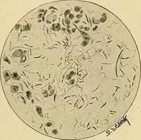 Picture 13 of 135 from Diagnostic methods, chemical, bacteriological and microscopical : a text-book for students and practitioners / by Ralph W. Webster ; with 37 colored plates and 164 other illustrations. (1909), leaf 85