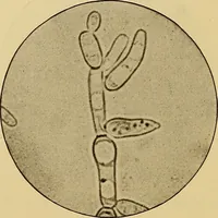 Picture 14 of 135 from Diagnostic methods, chemical, bacteriological and microscopical : a text-book for students and practitioners / by Ralph W. Webster ; with 37 colored plates and 164 other illustrations. (1909), leaf 86