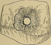 An illustration from Atlas and epitome of traumatic fractures and dislocations / by H. Helferich ; auth. tr. from the German, ed. by Joseph C. Bloodgood. (1902)