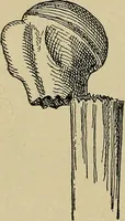 Picture 31 of 91 from Atlas and epitome of traumatic fractures and dislocations / by H. Helferich ; auth. tr. from the German, ed. by Joseph C. Bloodgood. (1902), leaf 232
