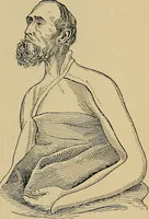 An illustration from Atlas and epitome of traumatic fractures and dislocations / by H. Helferich ; auth. tr. from the German, ed. by Joseph C. Bloodgood. (1902)