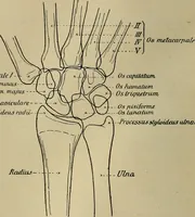 An illustration from Atlas and epitome of traumatic fractures and dislocations / by H. Helferich ; auth. tr. from the German, ed. by Joseph C. Bloodgood. (1902)