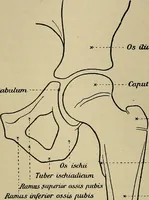 Picture 69 of 91 from Atlas and epitome of traumatic fractures and dislocations / by H. Helferich ; auth. tr. from the German, ed. by Joseph C. Bloodgood. (1902), leaf 368