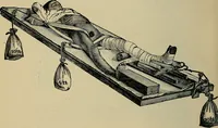 An illustration from Atlas and epitome of traumatic fractures and dislocations / by H. Helferich ; auth. tr. from the German, ed. by Joseph C. Bloodgood. (1902)