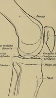 An illustration from Atlas and epitome of traumatic fractures and dislocations / by H. Helferich ; auth. tr. from the German, ed. by Joseph C. Bloodgood. (1902)