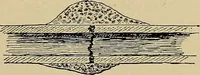 An illustration from Atlas and epitome of traumatic fractures and dislocations / by H. Helferich ; auth. tr. from the German, ed. by Joseph C. Bloodgood. (1902)