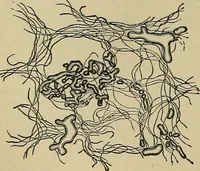 An illustration from Atlas and epitome of traumatic fractures and dislocations / by H. Helferich ; auth. tr. from the German, ed. by Joseph C. Bloodgood. (1902)